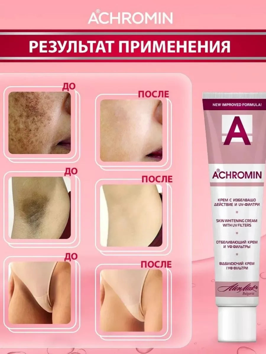 Original ACHROMIN cream 45ml UV Anti dark age Spots Freckles Skin Whitening face