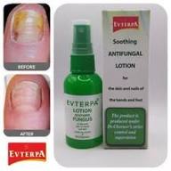 EVTERPA  Anti-Fungal Lotion for fingers and toes 50 ml KILLS 99.9% of nail Fungus on feet, toes, hands