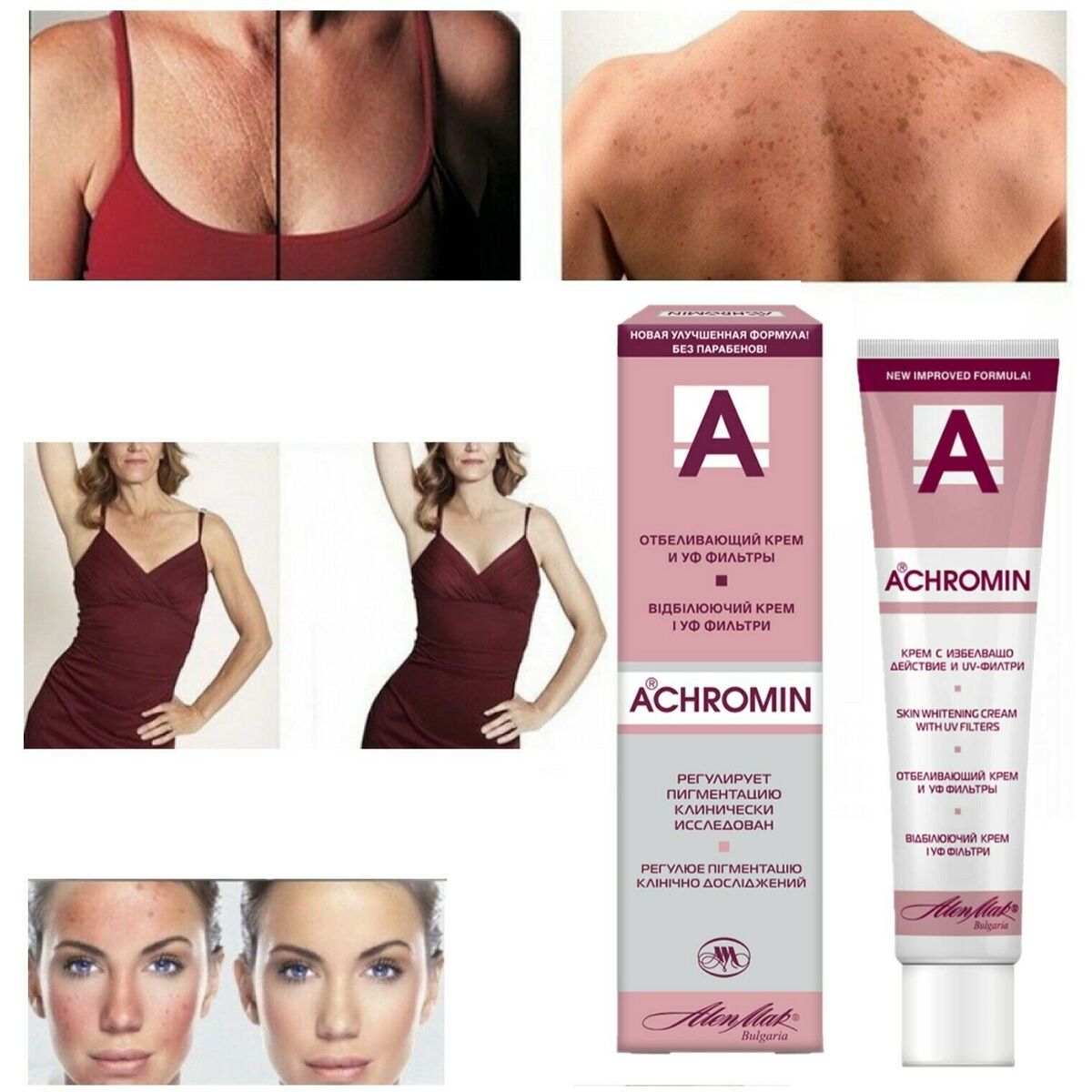 Lot of 30 pcs ACHROMIN®  whitening cream 45 ml