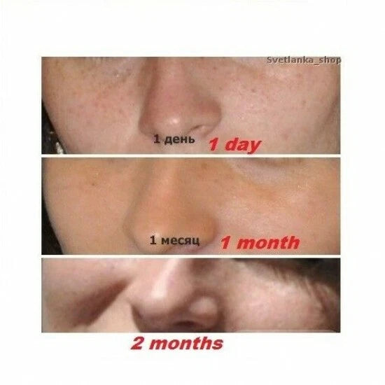 ACHROACTIVE MAX CREAM WHITENING EFFECT UV ACHROMAXYL DARK,AGE SPOT 45ml EU made