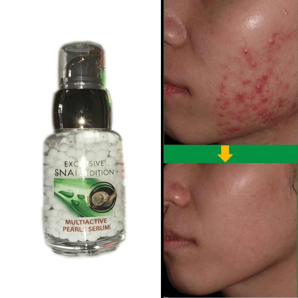 ARSY ROSA UNIQUA EXCLUSIVE SNAIL EDITION 30 ml MULTIACTIVE PEARLS SERUM SNAIL EXTRACT + HYALURONIC ACID