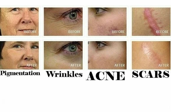 ARSY ROSA UNIQUA EXCLUSIVE SNAIL EDITION 30 ml MULTIACTIVE PEARLS SERUM SNAIL EXTRACT + HYALURONIC ACID