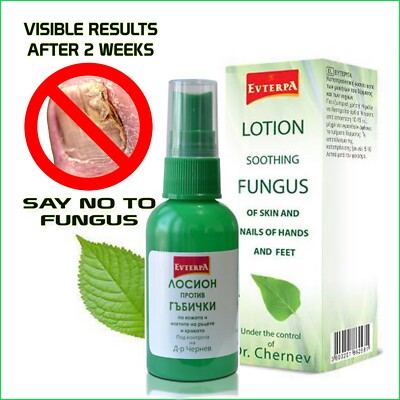 EVTERPA  Anti-Fungal Lotion for fingers and toes 50 ml KILLS 99.9% of nail Fungus on feet, toes, hands